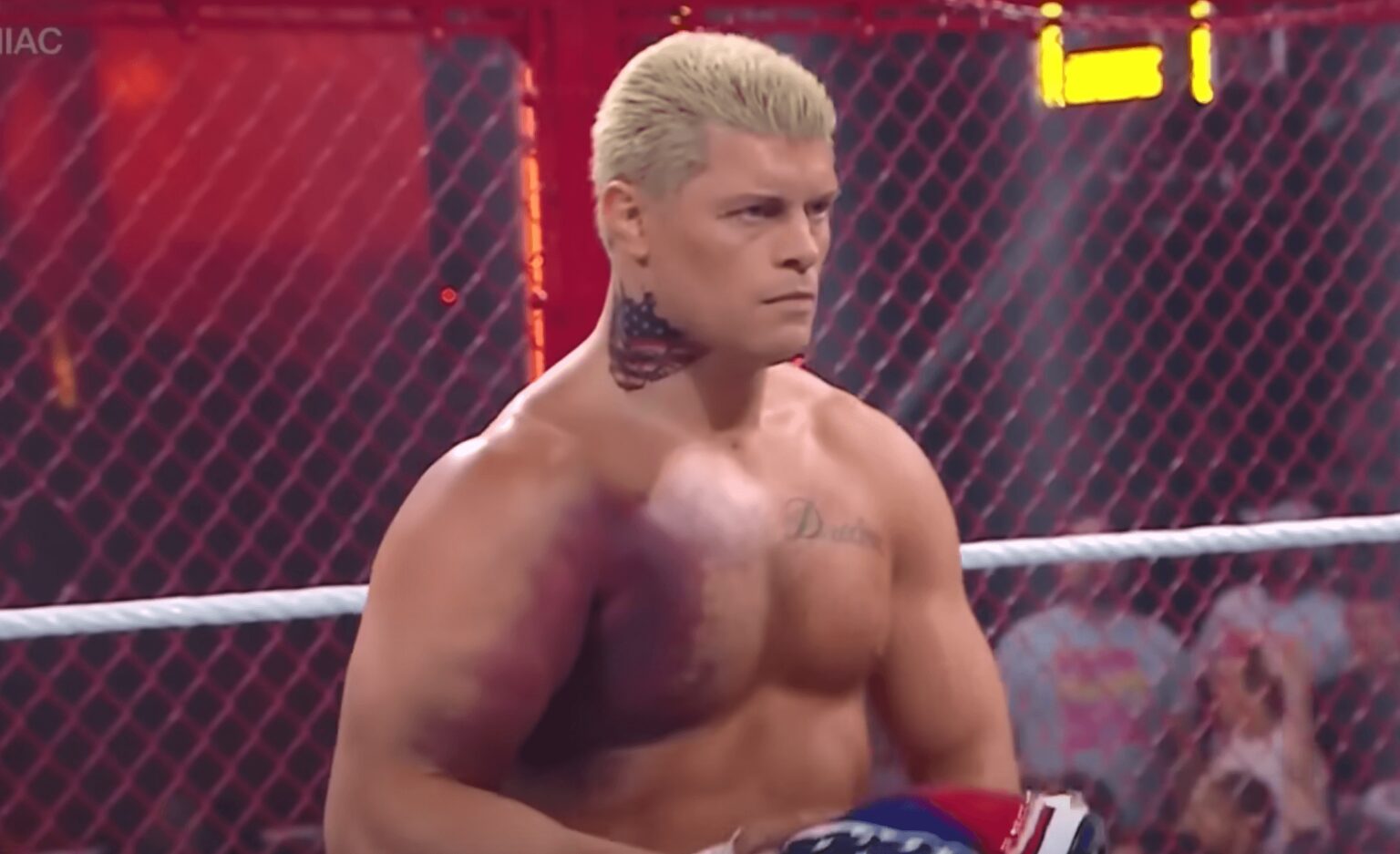 Cody Rhodes injury